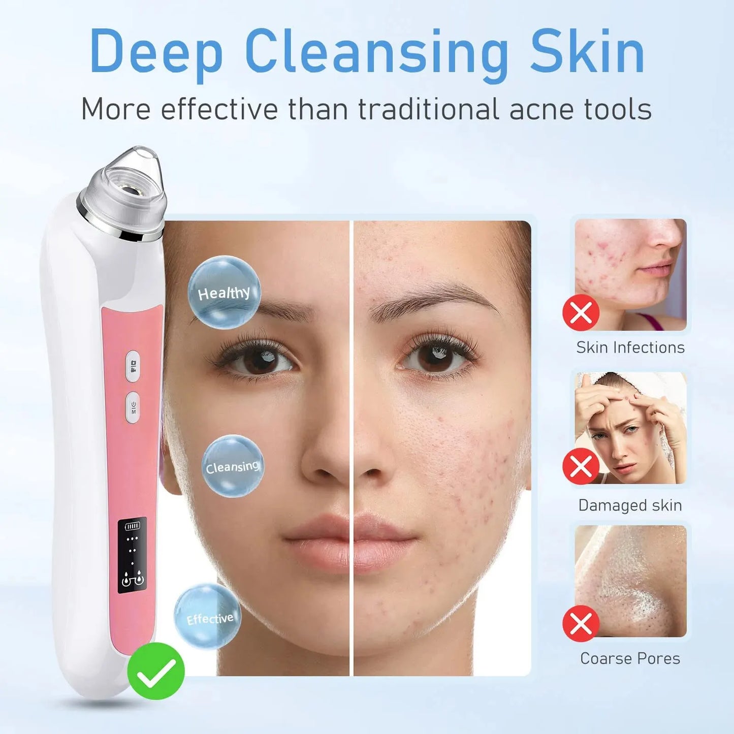 Electric Blackhead Remover Vacuum Acne Pore Cleaner Black Dots