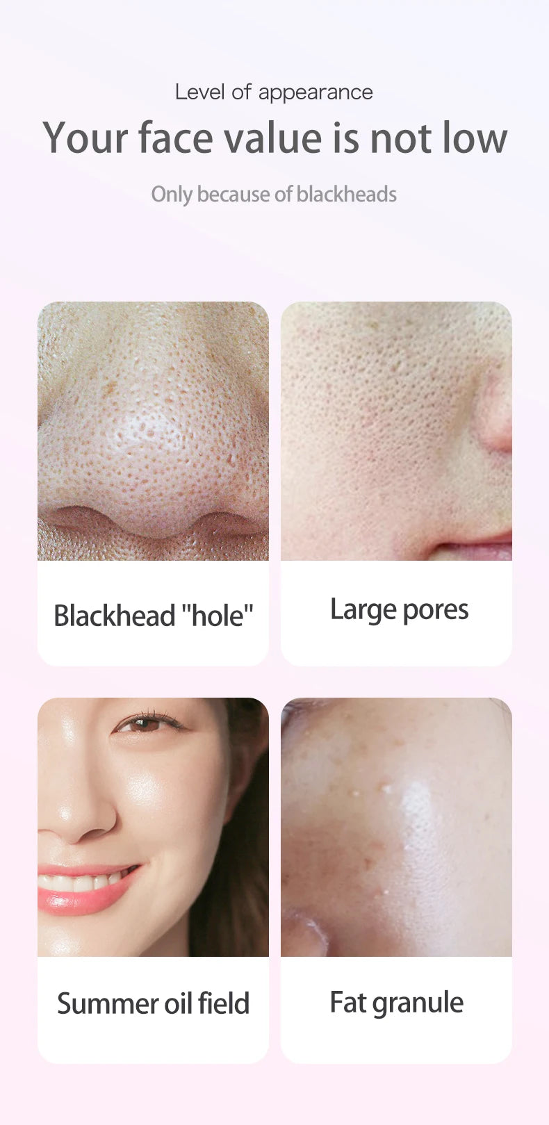 Electric Blackhead Remover Vacuum Acne Pore Cleaner Black Dots