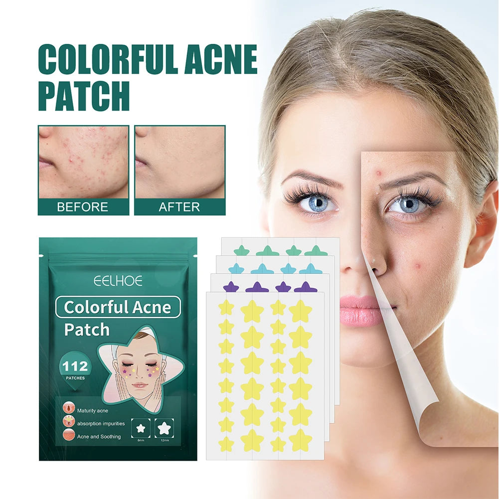 112pcs Concealer Star Shaped Hydrocolloid Acne Patches