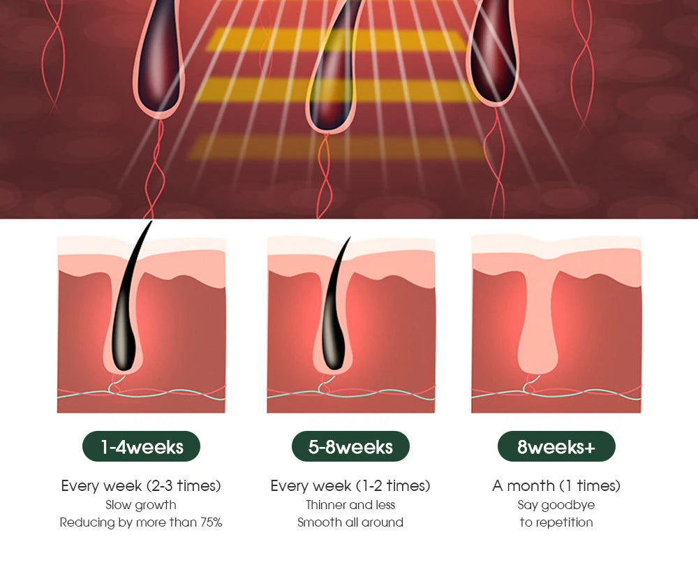 IPL Epilator Laser Hair Removal with LCD display